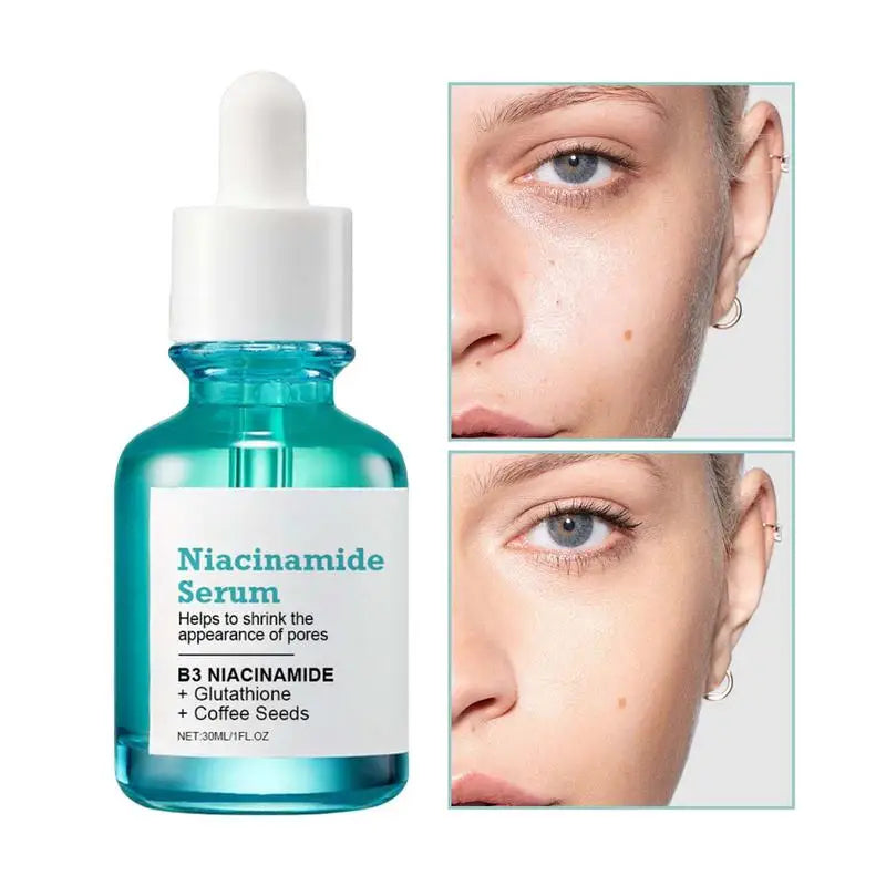 Niacinamide Serum Hyaluronic Acid Moisturizing Niacinamide Facial Serum Whitening Dark Spots Removal Rejuvenation Serum 30ml